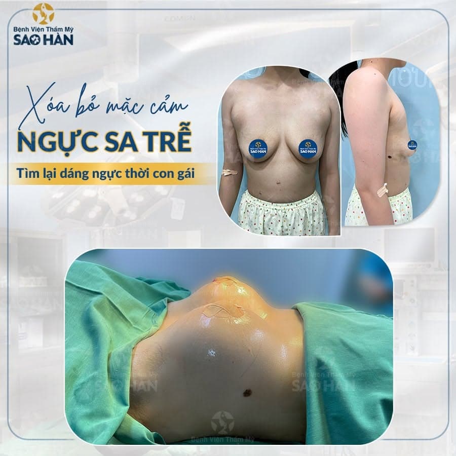 Ngực sa trễ: nguyên nhân và các giải pháp khắc phục