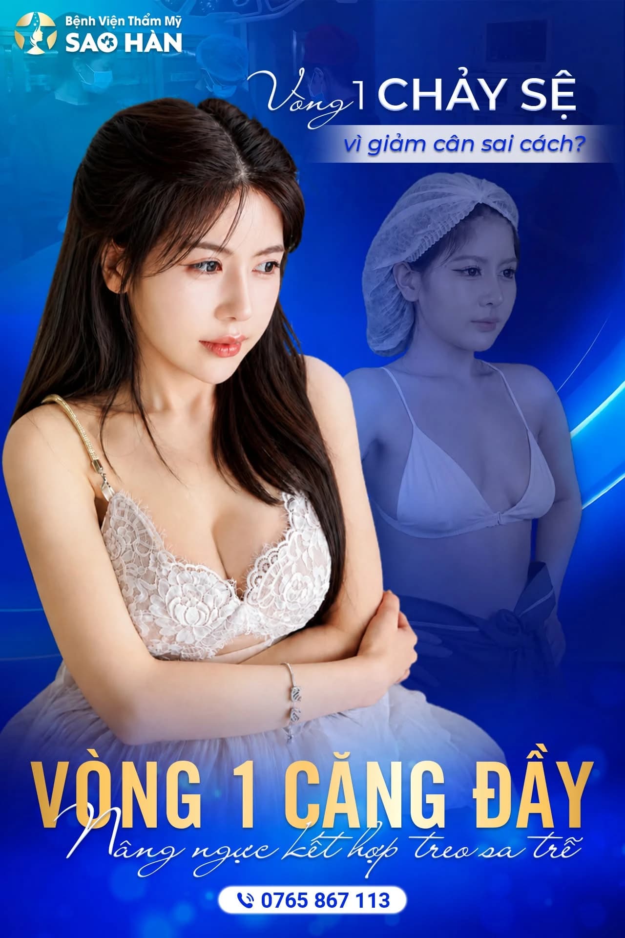 Vòng 1 căng đầy: nâng ngực kết hợp treo sa trễ tại Sao Hàn